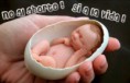 /album/fotogaleria-inicio1/no-al-aborto-jpg6/
